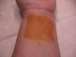 painting iodine on skin